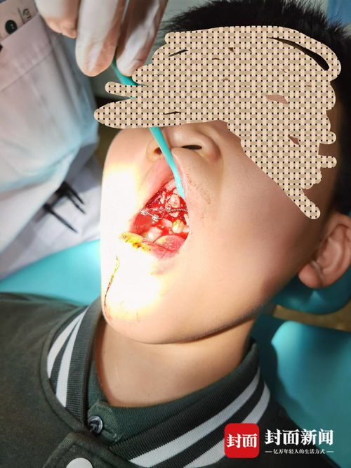 重慶特斯拉車主遭遇驚魂一幕 停車時(shí)車輛自動加速撞墻，致孩子受傷